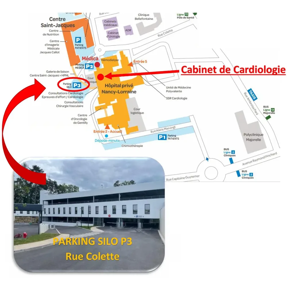 Plan d’accès au cabinet de cardiologie de Nancy (HPNL)